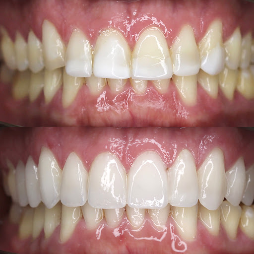 Clínica Dental P&P Clinic - Dentista — SALUD en Madrid